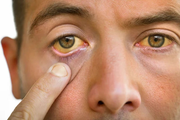Liver Symptoms You Must Not Overlook